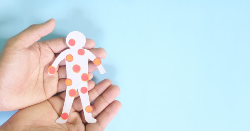 canada isi pierde statutul de tara fara rujeola sua sunt si ele aproape in aceeasi situatie 6912584d6399d