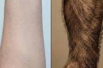 ce este pielea de gaina de fapt o incercare esuata a corpului tau de a parea fioros 69427a8484ac5