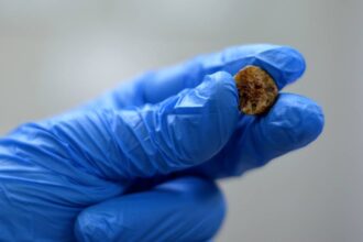 adio pietre la fiere alimentul de origine animala care poate reduce riscul de calculi biliari stimuleaza golirea vezicii biliare 6997f3c4dd271