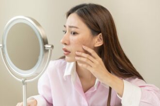 mit sau realitate samponul antimatreata poate vindeca acneea 69930297cfd9d