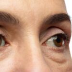 ochi umflati cand este o problema minora si cand trebuie sa mergi la medic 698ac009aff27