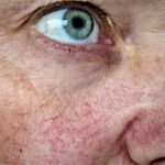 semnele de pe fata care pot trada excesul de alcool la ce sa fii atent 699c45f988c77