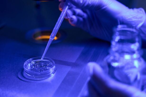 terapia cu celule stem o noua speranta pentru tratarea avc tara noastra are cea mai mare rata de mortalitate prin avc din europa 69984d3702ab0