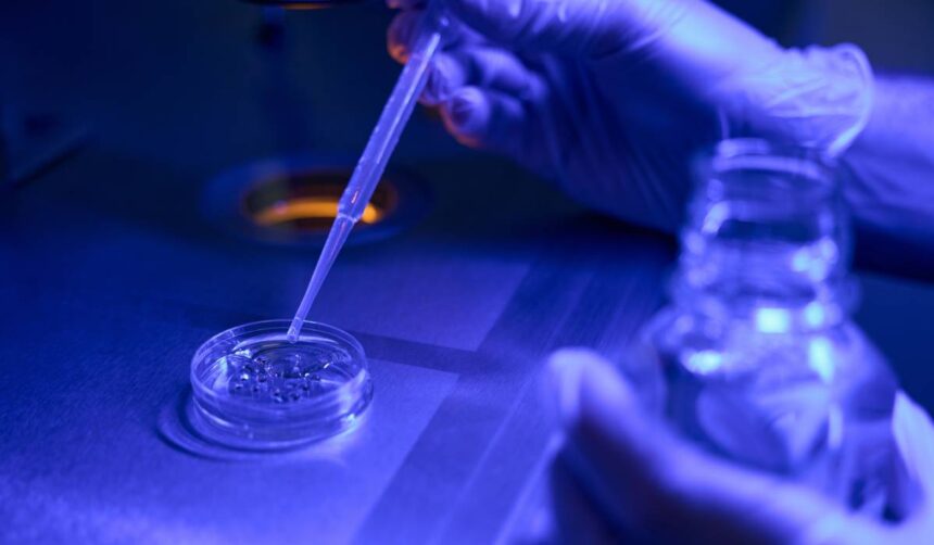 terapia cu celule stem o noua speranta pentru tratarea avc tara noastra are cea mai mare rata de mortalitate prin avc din europa 69984d3702ab0