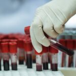cand ar trebui sa incepeti controalele medicale de rutina medicii explica ce analize trebuie sa faci la 25 35 si 45 de ani 69b64f9933187