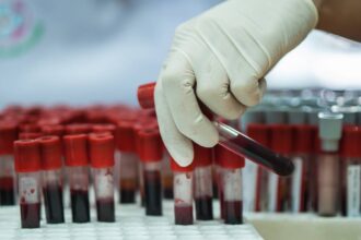 cand ar trebui sa incepeti controalele medicale de rutina medicii explica ce analize trebuie sa faci la 25 35 si 45 de ani 69b64f9933187