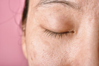 cum diferentiezi porii deschisi de cei inchisi ingrijirea corecta a tenului incepe acasa 69b141d9397e3