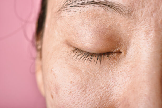 cum diferentiezi porii deschisi de cei inchisi ingrijirea corecta a tenului incepe acasa 69b141d9397e3