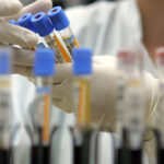 un studiu dezvaluie cele 37 de proteine din sangele centenarilor legate de o viata mai lunga si mai sanatoasa 69ad9d110e3f7