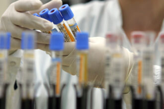 un studiu dezvaluie cele 37 de proteine din sangele centenarilor legate de o viata mai lunga si mai sanatoasa 69ad9d110e3f7