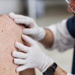 boala pielii de fluture afectiunea rara care poate transforma viata intr o lupta zilnica cazul dramatic al unui barbat cu acest diagnostic 69eb857947698
