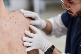 boala pielii de fluture afectiunea rara care poate transforma viata intr o lupta zilnica cazul dramatic al unui barbat cu acest diagnostic 69eb857947698