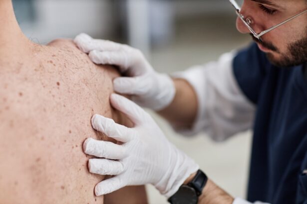 boala pielii de fluture afectiunea rara care poate transforma viata intr o lupta zilnica cazul dramatic al unui barbat cu acest diagnostic 69eb857947698