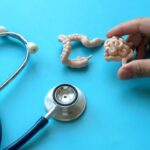de ce tot mai multi tineri se imbolnavesc de cancer de colon fenomenul a devenit ingrijorator la nivel global 69e0f01881c1b