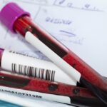 ce analize de sange pot arata daca diabetul a afectat deja rinichii 6a1bb6fa4251a