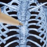 organul misterios din corp care ar asigura longevitatea si ar putea actiona impotriva cancerului i se mai spune si sediul sufletului sau cimitirul de celule 6a0ffef7e4e0b