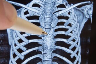 organul misterios din corp care ar asigura longevitatea si ar putea actiona impotriva cancerului i se mai spune si sediul sufletului sau cimitirul de celule 6a0ffef7e4e0b