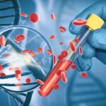 test revolutionar pentru cancerul pancreatic asimptomatic acuratete de 97 si sperante pentru depistarea bolii in stadii incipiente 69fdb8d900ada