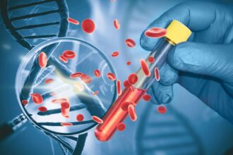 test revolutionar pentru cancerul pancreatic asimptomatic acuratete de 97 si sperante pentru depistarea bolii in stadii incipiente 69fdb8d900ada
