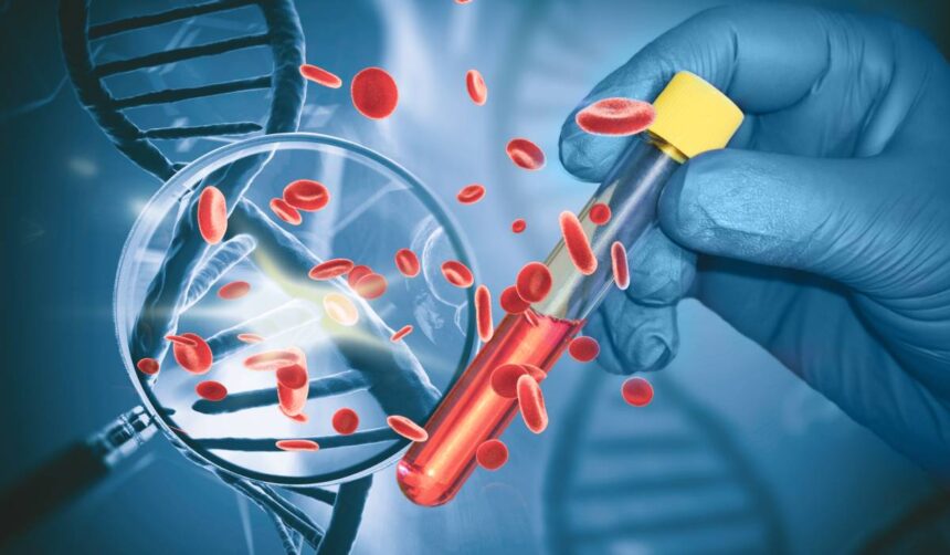 test revolutionar pentru cancerul pancreatic asimptomatic acuratete de 97 si sperante pentru depistarea bolii in stadii incipiente 69fdb8d900ada