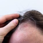 loviturile la cap si cucuiele cand sunt inofensive si in ce situatii trebuie sa mergi de urgenta la medic 6a239ffaaedfc